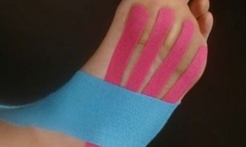 Vendajes musculares y neuromusculares